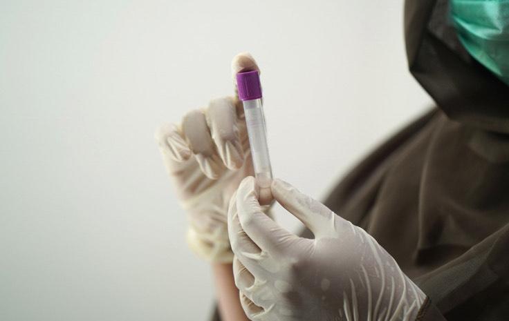 Prescient Therapeutics Doses First Patient in Phase 2a PTX-100 Trial for Rare T-Cell Lymphoma