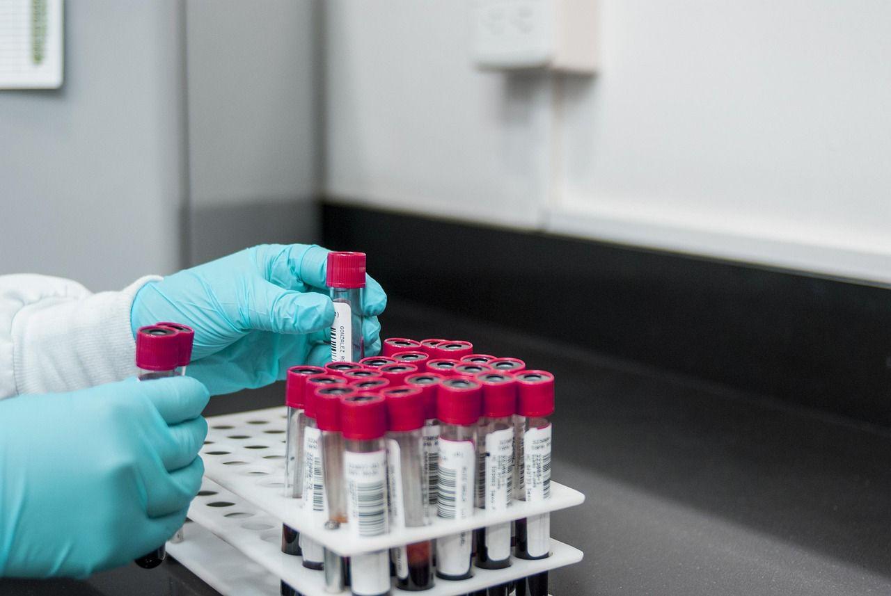 Vitrafy (ASX: VFY) Smashes Global Benchmarks as US Military Study Validates “No-Wash” Blood Preservation Tech